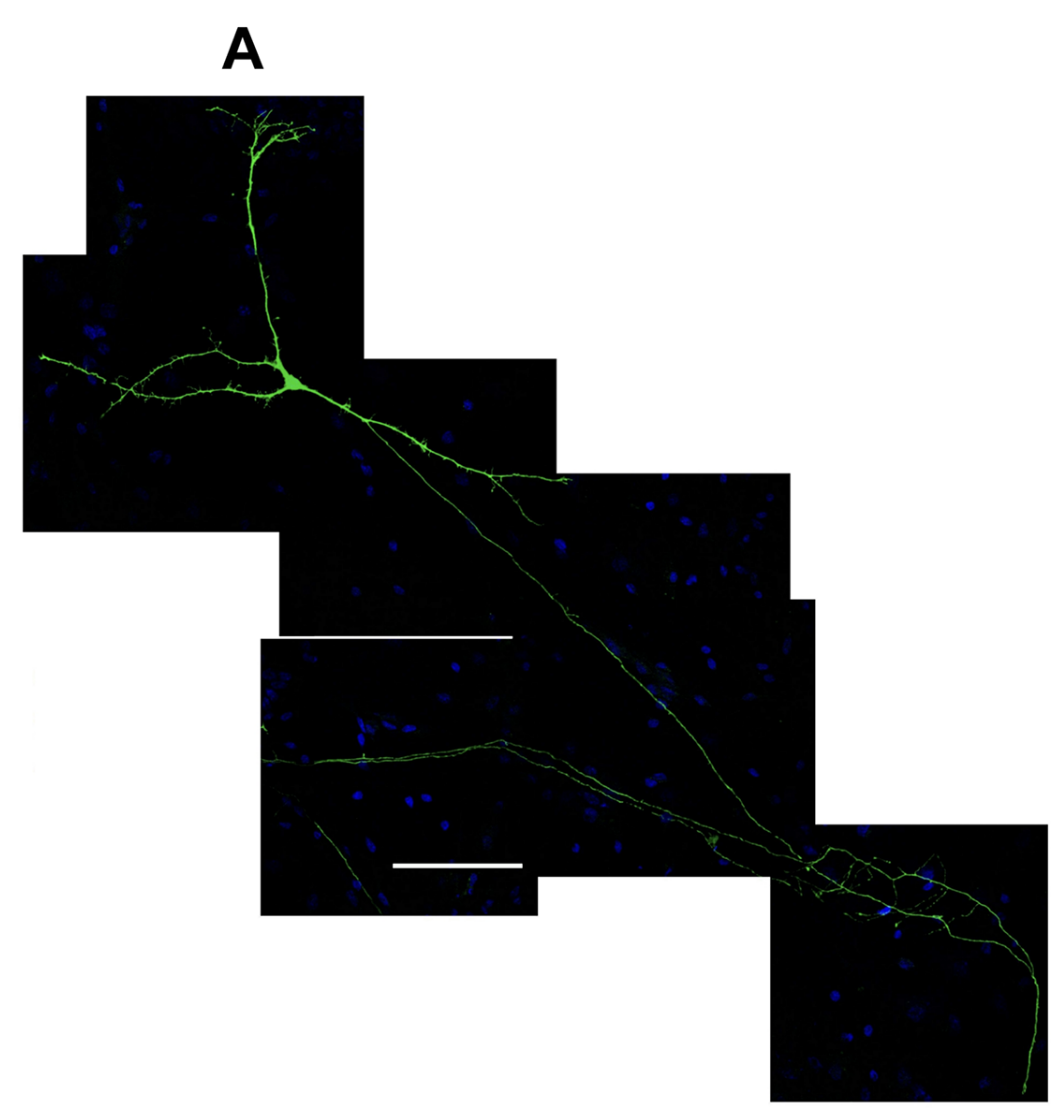 Iron Chelators and Antioxidants Regenerate Neuritic Tree and Nigrostriatal Fibers of MPP+/MPTP-Lesioned Dopaminergic Neurons